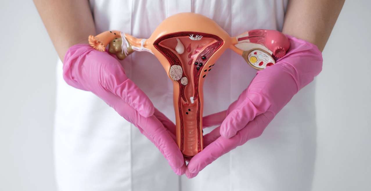 Fibroids
