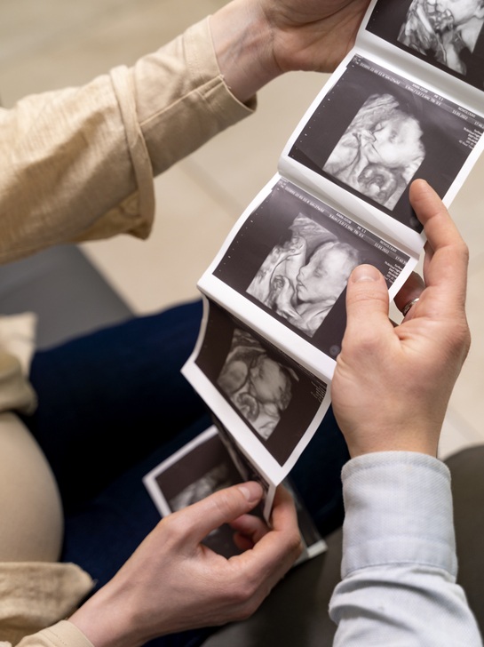 gynecologist-offering-couple-ultrasound-pictures(1)